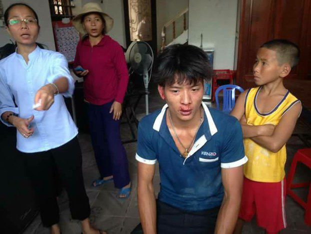 Một người dân, cũng là giáo dân Công giáo, tại huyện Quỳnh Lưu, tinh Nghệ An bị hành hung đến thương tích nặng vào sáng ngày chủ nhật 28 tháng 5.